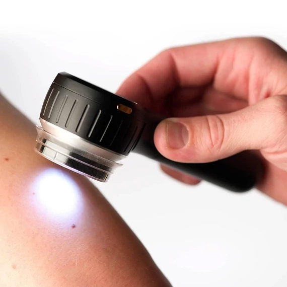 DermLite DL4 dermatoszkóp